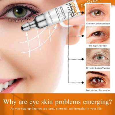 Dark Circles Removal Cream
